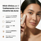 Stick Clinico per il Trattamento delle Cicatrici da Acne