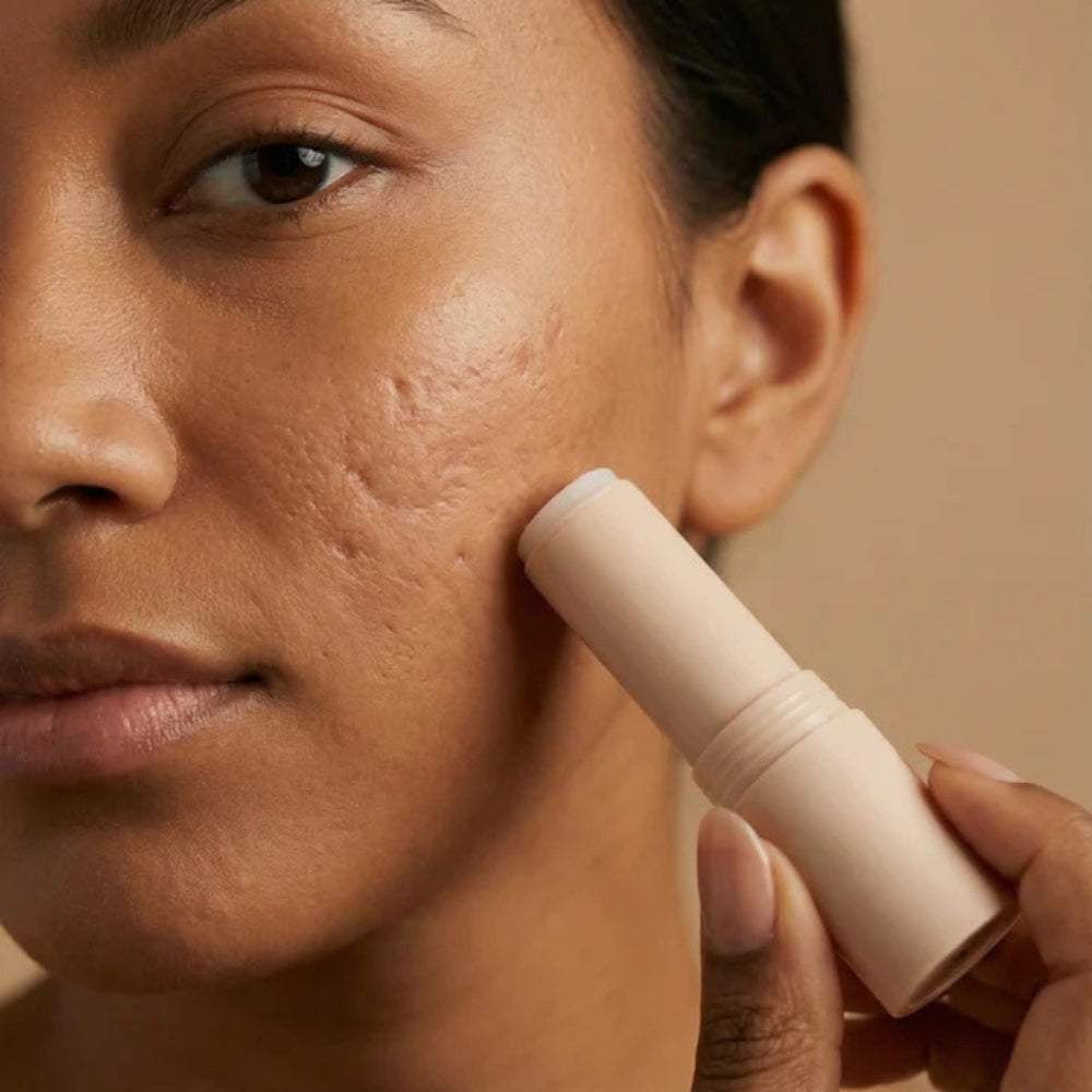 Stick Clinico per il Trattamento delle Cicatrici da Acne